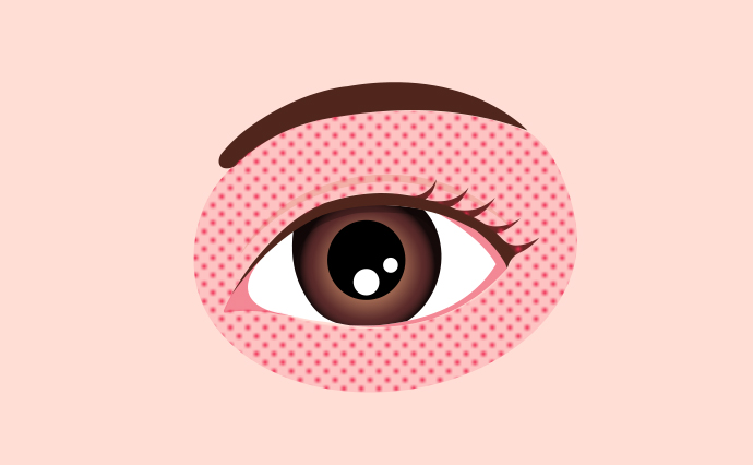 レーザー治療イラスト