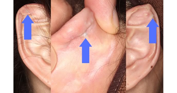 初診時の診察写真