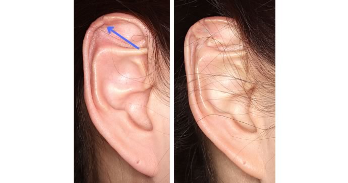 右 術前と術後の比較写真