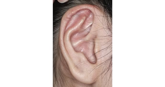 術後3ヵ月 横写真