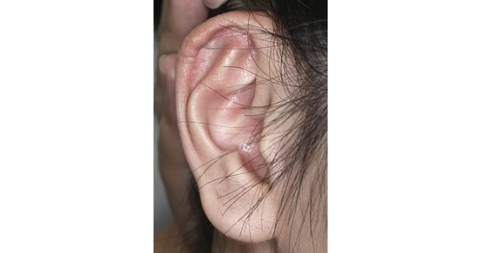 術後3ヵ月 前写真