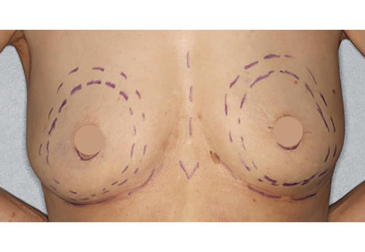 デザインの写真