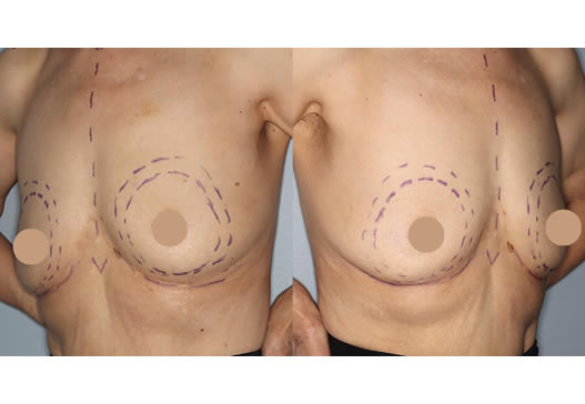 デザイン(左右斜め)の写真