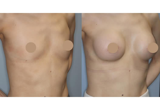 デザインの写真