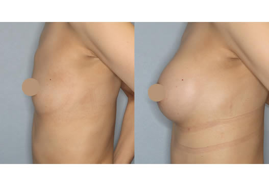 デザインの写真