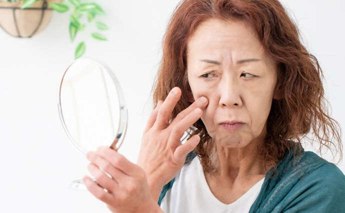 眼瞼下垂の特徴