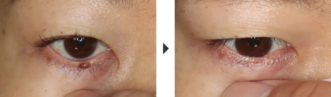 術前と術後の比較