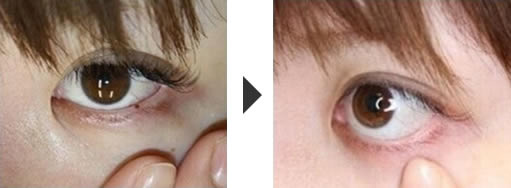 術前と術後の比較