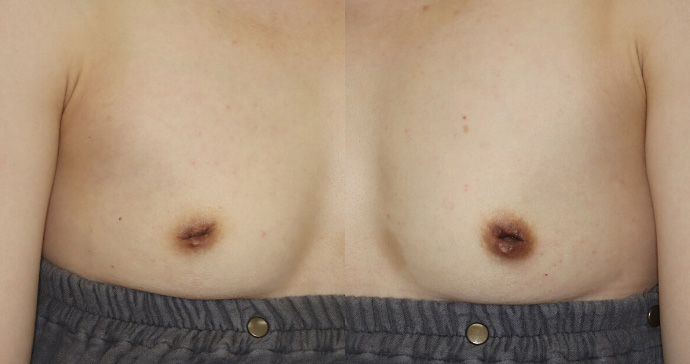 è¡åã®èšºå¯ã®åç