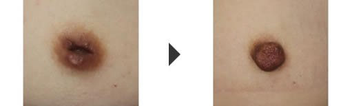 è¡åãšè¡åŸã®æ¯èŒã®åç