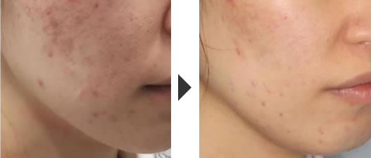 術前と術後の比較