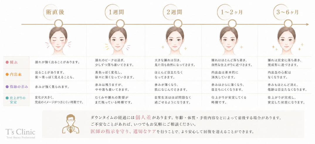 目の下のたるみ取り手術後のダウンタイム経過目安